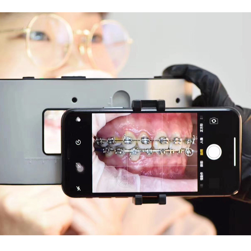 Nueva Lámpara Dental con Sopor - Photography With Lighting reseña y precio
